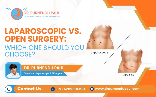Laparoscopic vs. Open Surgery: Which One Should You Choose? Laparoscopic vs. Open Surgery: Which One Should You Choose?