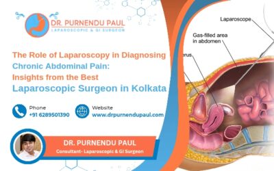 The Role of Laparoscopy in Diagnosing Chronic Abdominal Pain: Insights from the Best Laparoscopic Surgeon in Kolkata