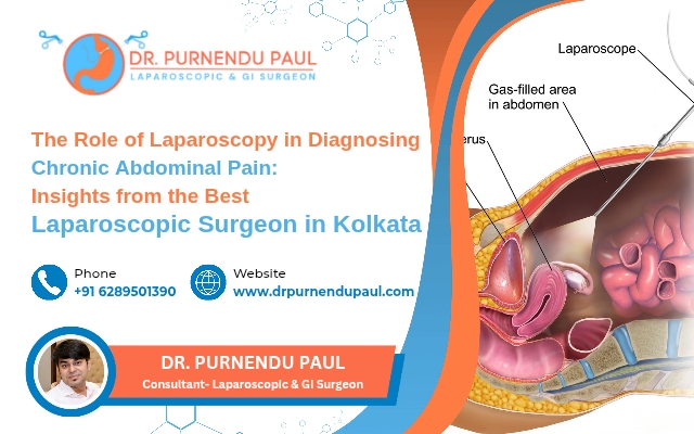The Role of Laparoscopy in Diagnosing Chronic Abdominal Pain: Insights from the Best Laparoscopic Surgeon in Kolkata